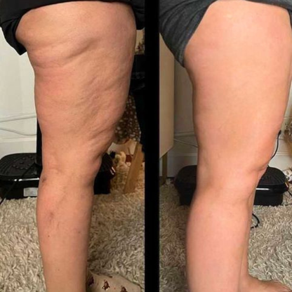 Oce Aura Crema Anticelulitis