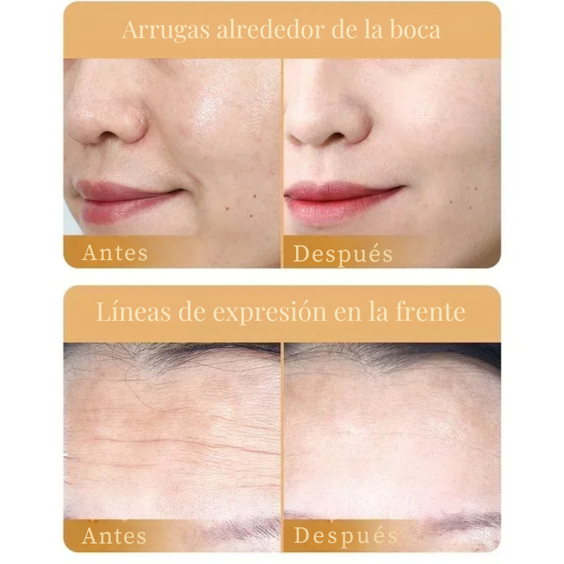 Sadoer Mascarilla Anti-Aging de Colágeno
