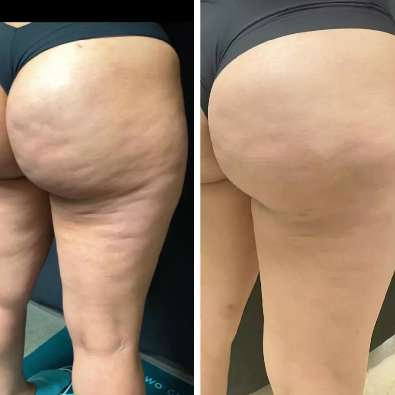 Oce Aura Crema Anticelulitis