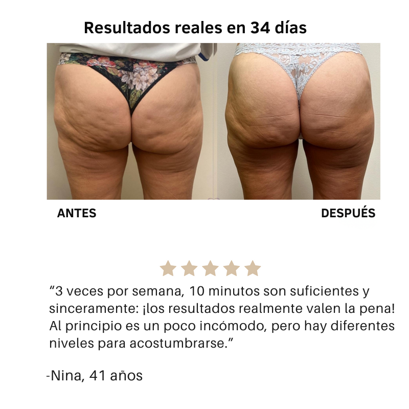 Livia Masajeador Anticelulitis