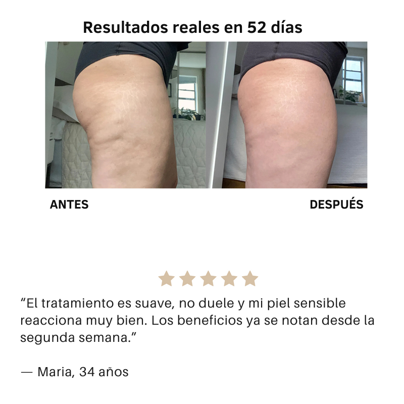 Livia Masajeador Anticelulitis