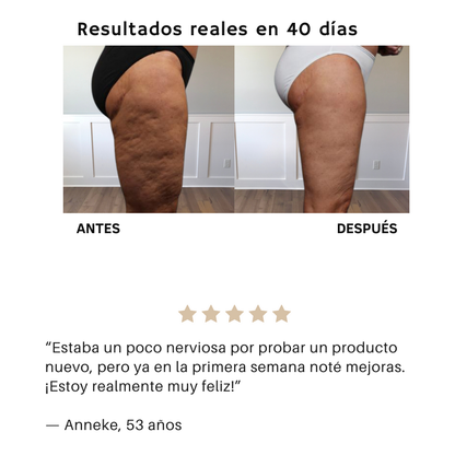 Livia Masajeador Anticelulitis