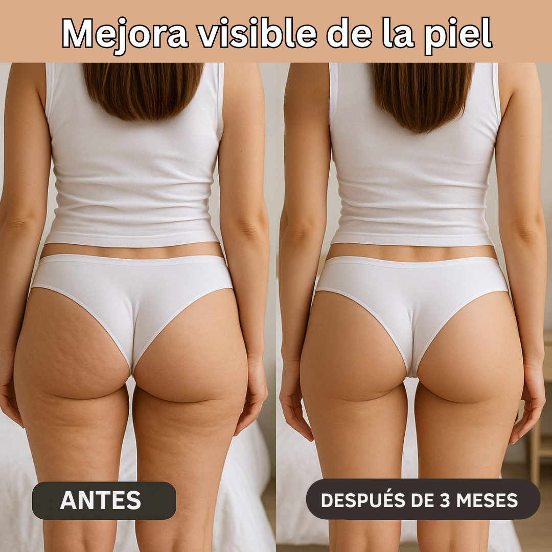 NOVA | Innovative 3D Anti-Cellulite Leggings