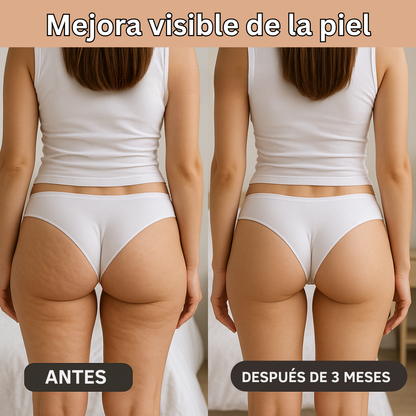 NOVA | Innovative 3D Anti-Cellulite Leggings