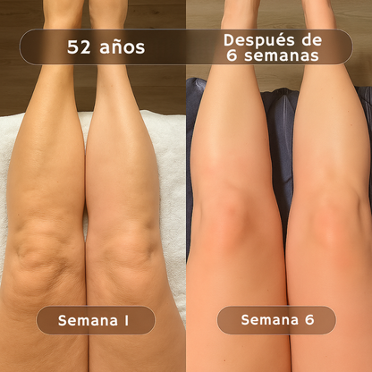 Flowziax Aceite de Masaje Anticelulítico