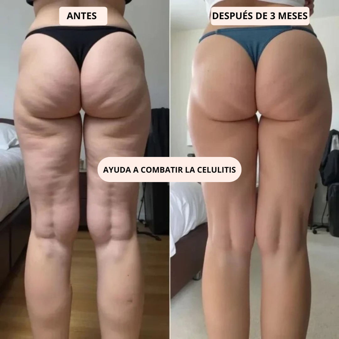 NOVA | Innovative 3D Anti-Cellulite Leggings