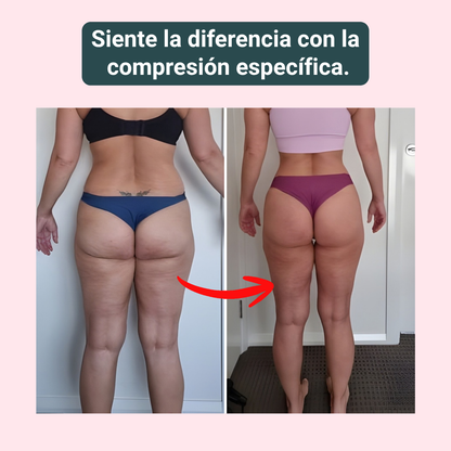 NOVA | 3D Compression Leggings for Lymphedema Comfort